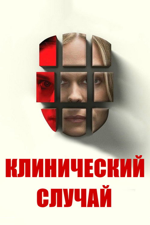 Постер фильма «Клинический случай»
